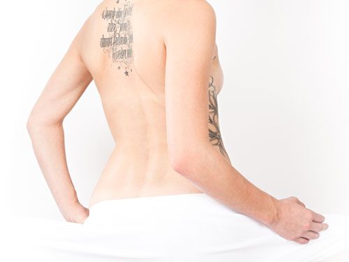 Fettabsaugung Behandlung: Rücken